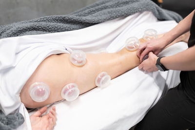 Cupping therapy, Children, Athletes, Best Massage Sherwood Park